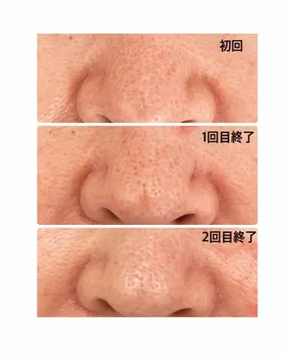 温活美肌専門サロン Lien『リアン』のエステ・リラクイメージ