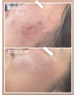 nature  s oin ICHIKAのエステ・リラクイメージ