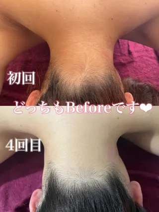 毛穴/シミ肝斑/脱毛 横山梨里のエステ・リラクイメージ