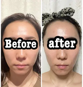 メンズ ネイル マツエク・マツパ ルシール ユーのエステ・リラクイメージ