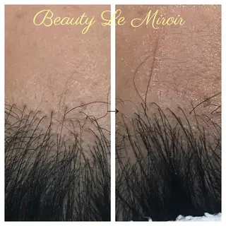 ビューティー ミロワールのエステ・リラクイメージ