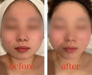 Espoir /エスポワール所属・三澤 秀基のエステ・リラクイメージ