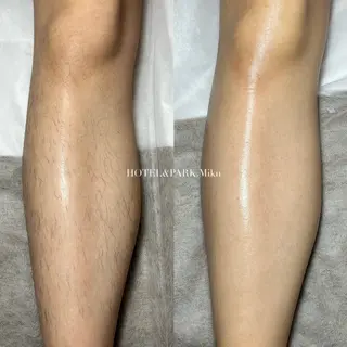 HOTEL&PARK . ワックス脱毛のエステ・リラクイメージ