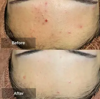 メンズ キッズ 美肌と癒しのサロン Lu,Mieのエステ・リラクイメージ