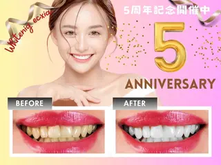 セルフホワイトニング エクシア 高田馬場のその他イメージ