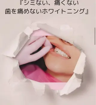 ホワイトニング ショップ伊丹店のその他イメージ