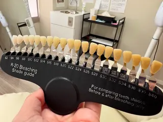 ホワイトニング ショップ伊丹店のその他イメージ