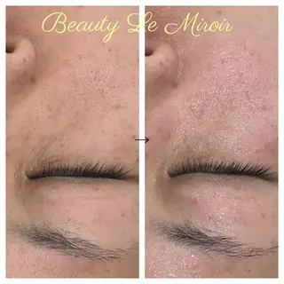 ビューティー ミロワールのエステ・リラクイメージ