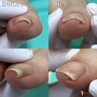 ネイル 大宮 巻き爪補正店のエステ・リラクイメージ