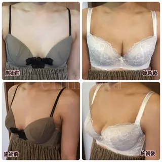 バストサロン emiruka所属・バストアップサロン エミルカのその他イメージ