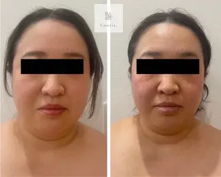 小顔サロン Moanaのエステ・リラクイメージ