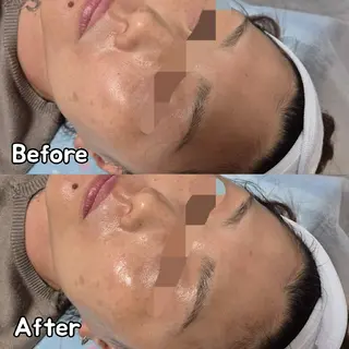 FERNABELL所属・岩本 ひなののエステ・リラクイメージ