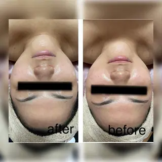 ビューティーサロン B.glossyのネイルデザイン