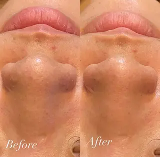 肌質改善専門 ハーブ /毛穴洗浄 リエイトのエステ・リラクイメージ