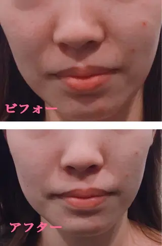 小顔サロン ソ.ルシエのエステ・リラクイメージ