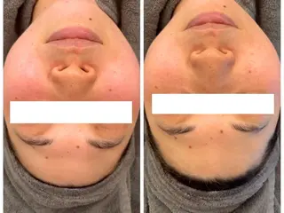 シミケア専門サロンLICCO’S所属・シミケア専門サロン LICCO’S岡崎のエステ・リラクイメージ