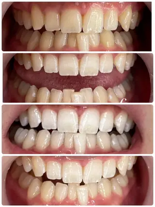 Beauty careのエステ・リラクイメージ