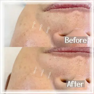 MONSTERA リナのエステ・リラクイメージ