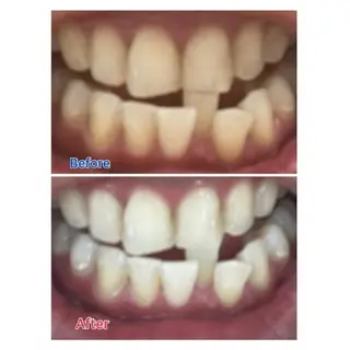 Ｍ渋谷 ホワイトニングのエステ・リラクイメージ