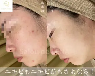 ハーブピーリング専門 グランディール　武内のエステ・リラクイメージ