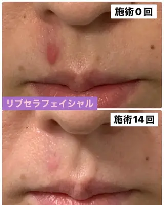 プライベートサロン プリュネルのエステ・リラクイメージ