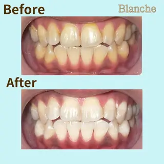 Blanche 心斎橋のその他イメージ