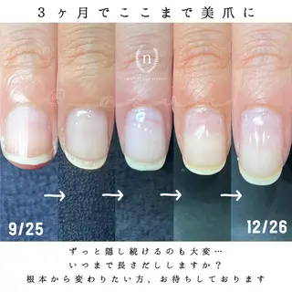 ネイル 自爪育成専門サロン ◌𓈒azumiのネイルデザイン