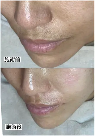 マツヤニWax専門/ 岸和田/Luanaのエステ・リラクイメージ