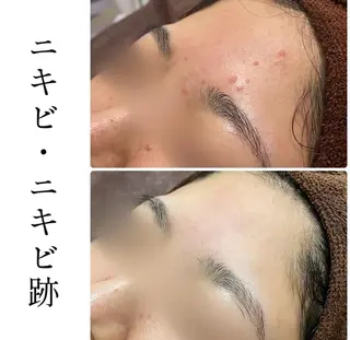 ハーブピーリング専門 BIOPLUS+川崎のエステ・リラクイメージ