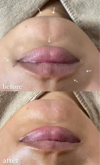 エステサロン Mi-mi.iのエステ・リラクイメージ