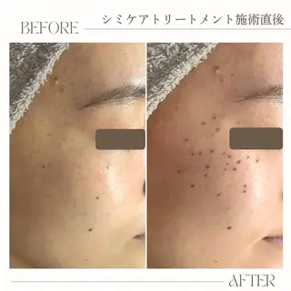 シミケア・肌育サロン Jullyのエステ・リラクイメージ