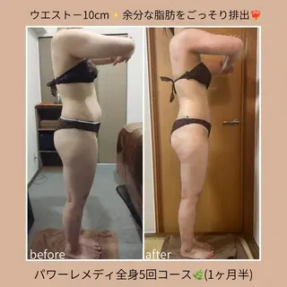 《本気痩せ×疲労改善 》  BILOOPのエステ・リラクイメージ