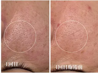 フェイシャルサロンKey of Face所属・村上 貴子のエステ・リラクイメージ