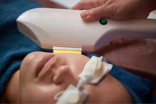 美楽鍼 びらくしんのその他イメージ