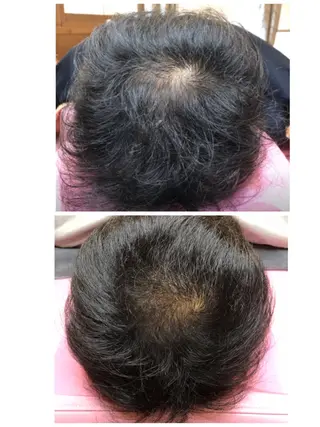 かすがい鍼灸院 Re.heartのエステ・リラクイメージ