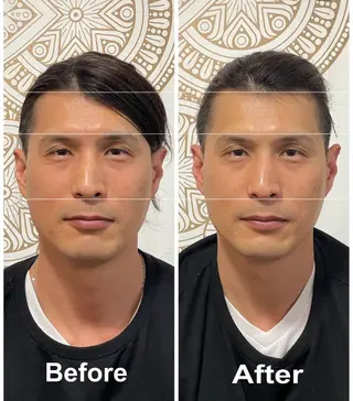 あだち整体エステ 首肩背中のゆるめぐのエステ・リラクイメージ