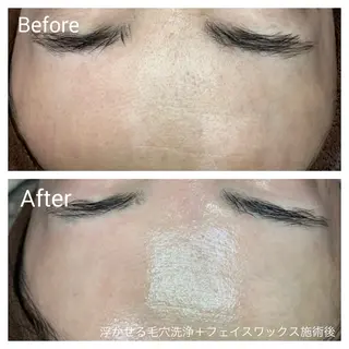 深い肌悩み専門 フェイシャルサロンのエステ・リラクイメージ