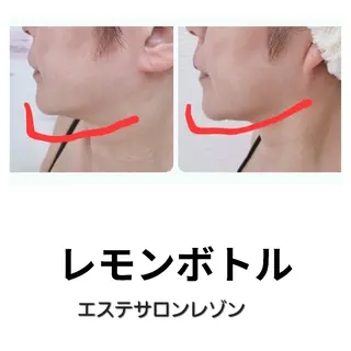 ニキビ・ニキビ跡専門 レゾン京橋店　のエステ・リラクイメージ