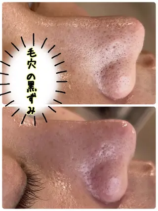 Dione八王子店所属・LUKE （ルーク）のエステ・リラクイメージ