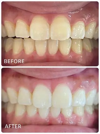 ホワイトニングサロン ラウレアのその他イメージ