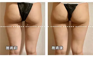 🌴Beauty Salon LANAのエステ・リラクイメージ