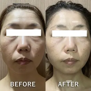 堀江リンパマッサージ 肩こり/リンパ/小顔のエステ・リラクイメージ