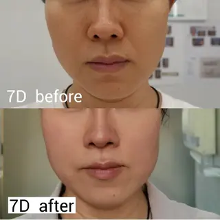 マツエク・マツパ aliaハーブ水光店 エステティシャン募集のエステ・リラクイメージ