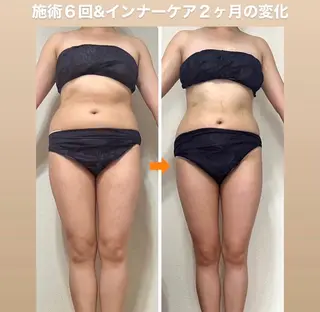 ‍痩身＆ボディ 結果出し🌟丹野のエステ・リラクイメージ