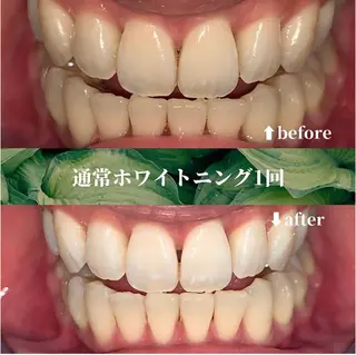 futaba ホワイトニング/天神のエステ・リラクイメージ