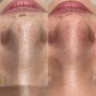 NACHUL MANAのその他イメージ