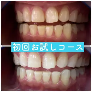 ホワイトニングルーム 横浜店のその他イメージ