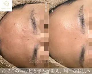 ハーブピーリング専門 グランディール　武内のエステ・リラクイメージ