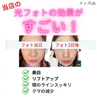 LUMINAルミナ 【肌管理サロン】のその他イメージ