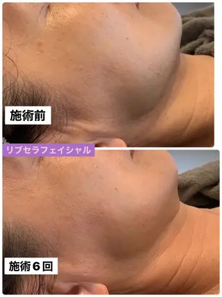 プライベートサロン プリュネルのエステ・リラクイメージ